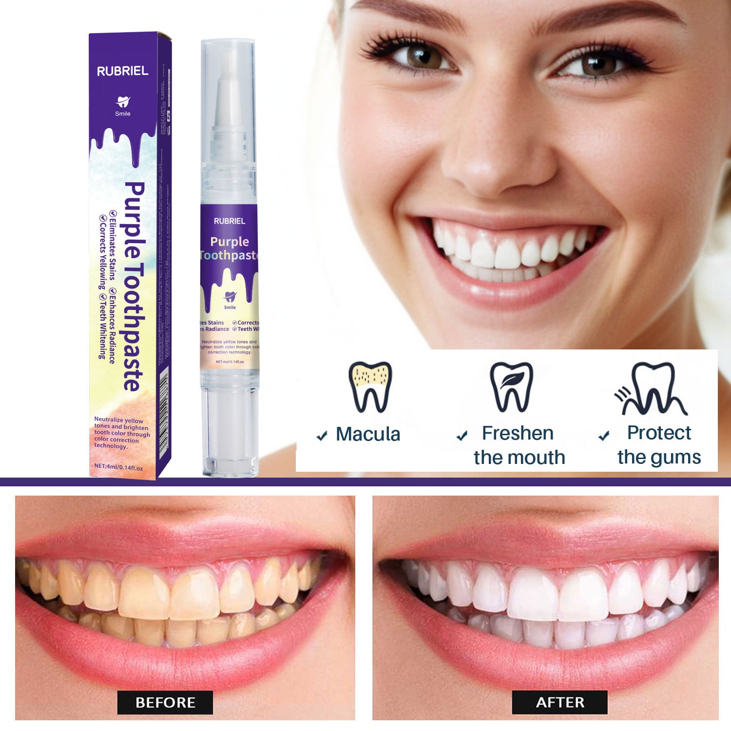 Paarse Tanden Bleken Pen - Teeth Whitening Pen voor Witte Tanden